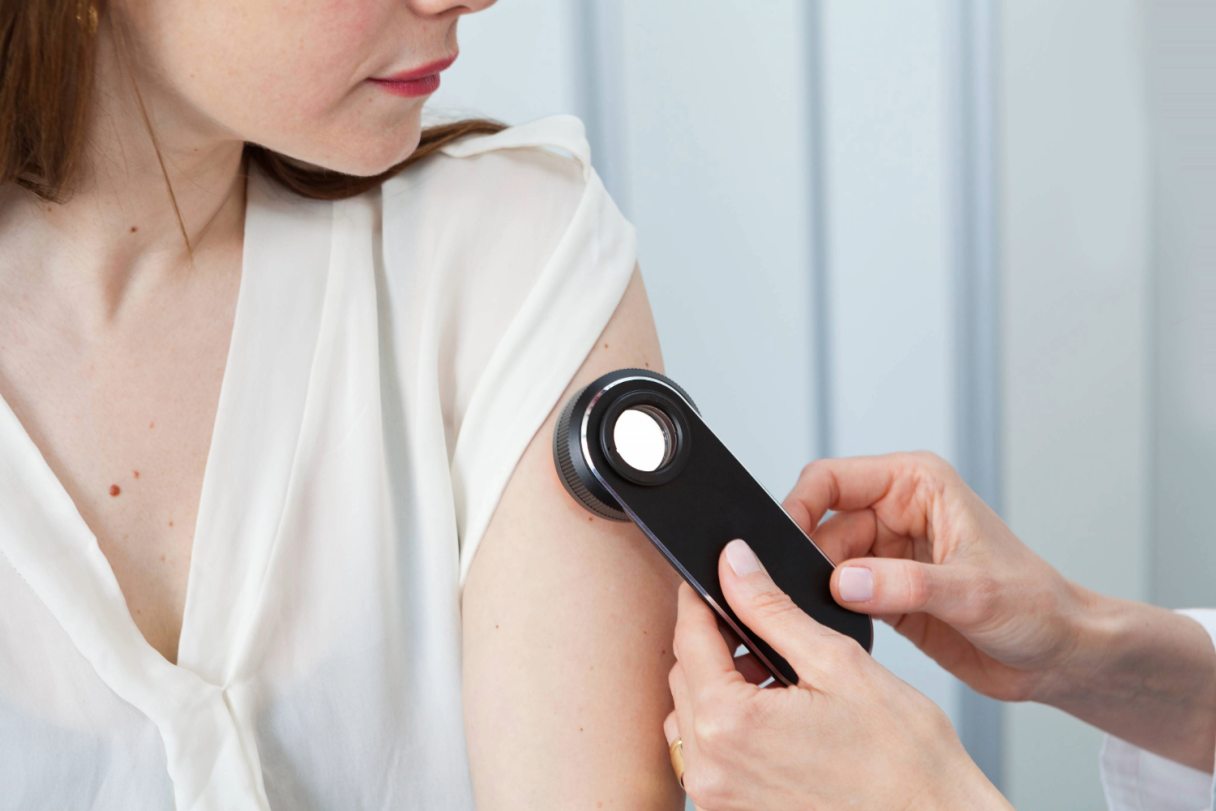 Dermatologa konsultācija